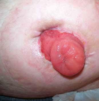 U2411: nasza_troska_37_2012_obrzęk.bmp