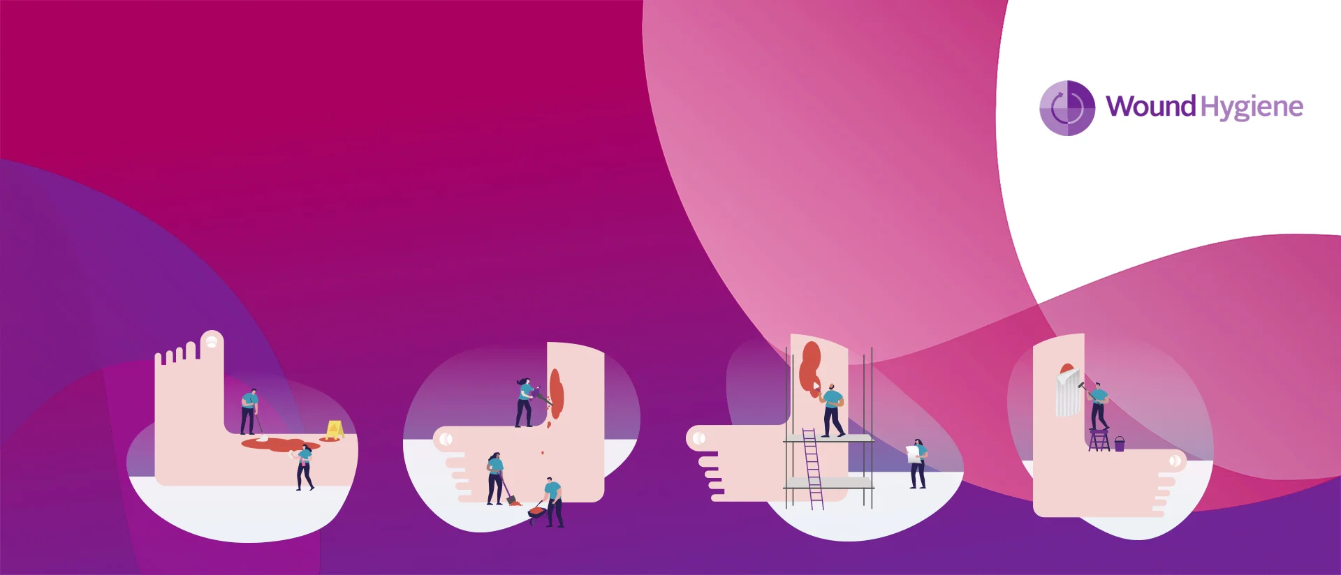 Concept d’hygiène des plaies : quatre étapes simples pour un soin optimal des plaies