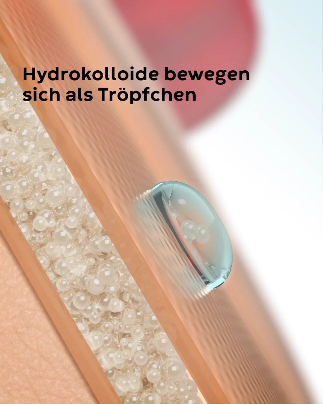 Vidéo montrant le fonctionnement des hydrocolloïdes de Convatec