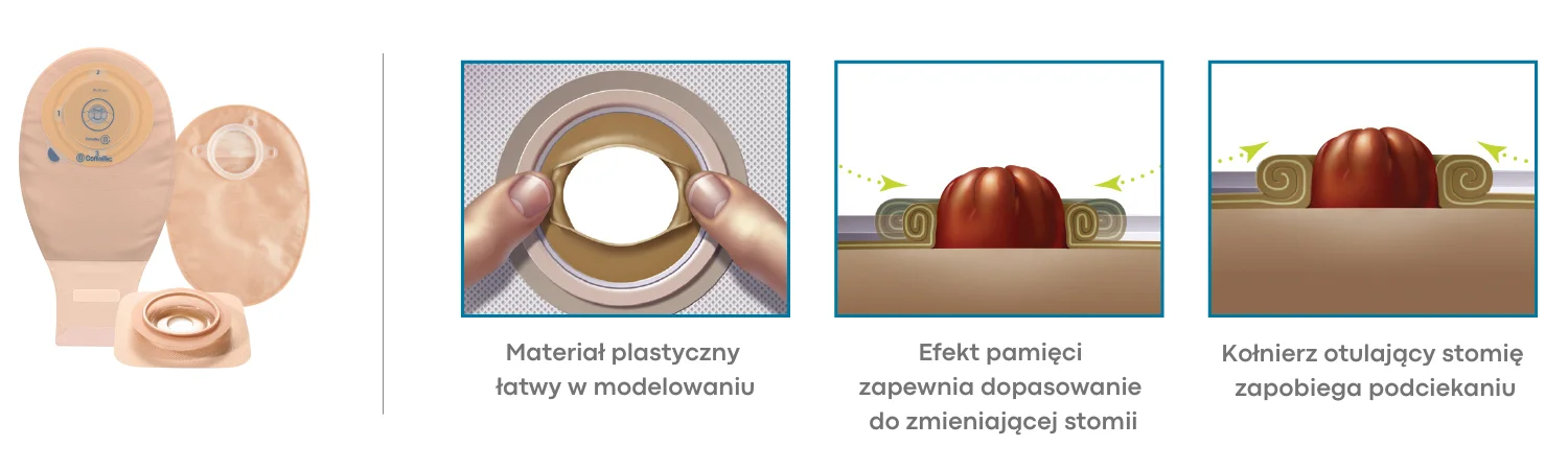Stomia o nieregularnym kształcie 