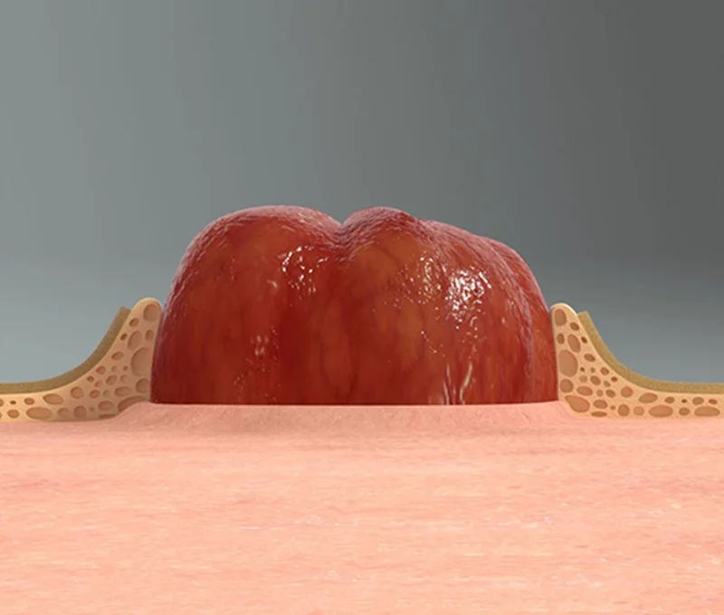 ein rot-weißes Objekt