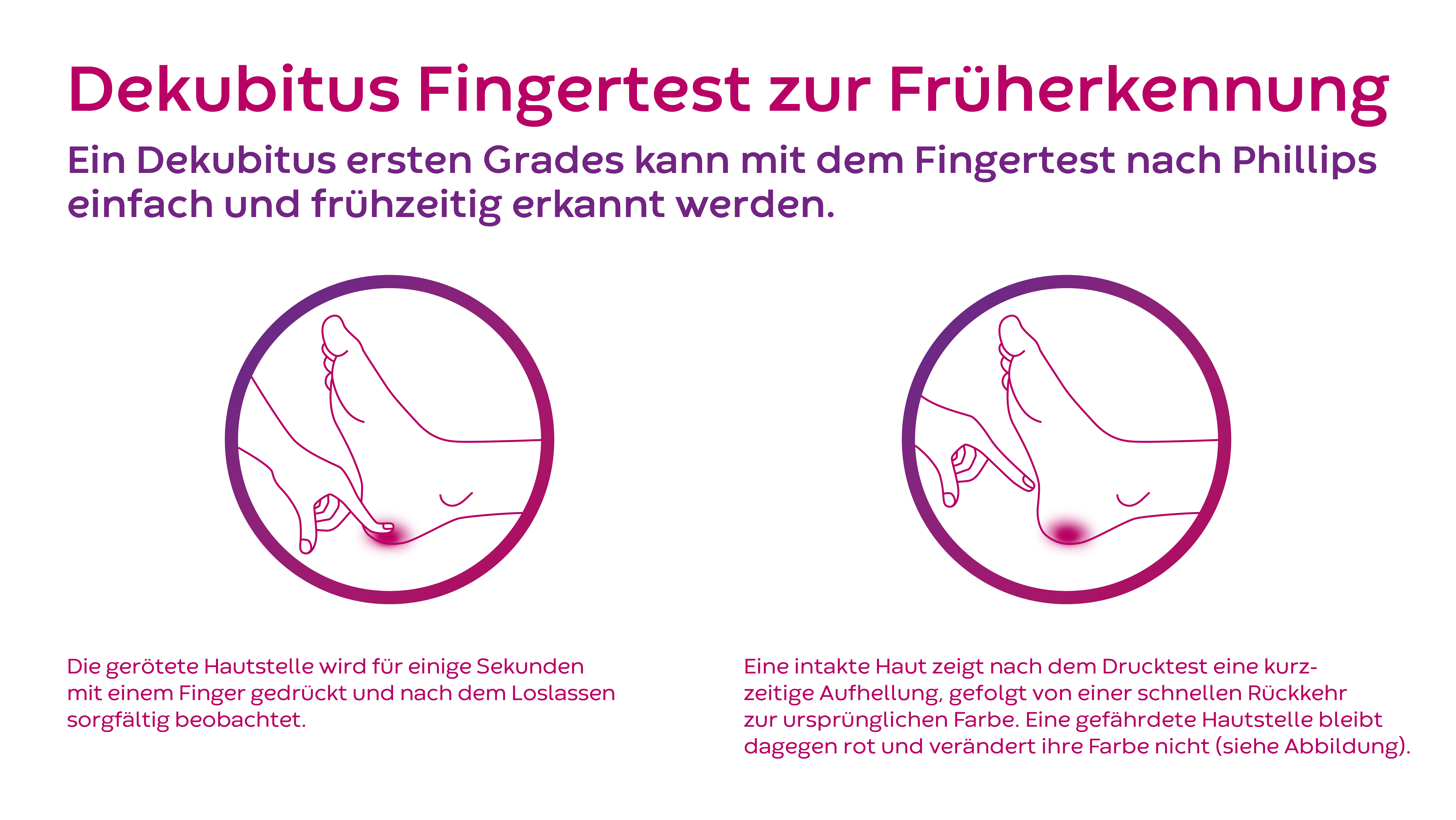 Dekubitus Test zur Früherkennung nach Philips